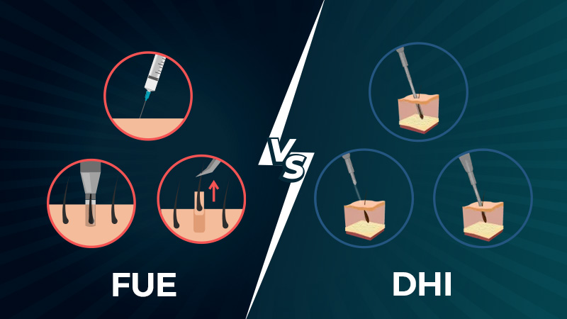 Hair Transplant Cost Breakdown 2026 in Turkey